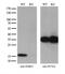 NME/NM23 Nucleoside Diphosphate Kinase 4 antibody, M06126, Boster Biological Technology, Western Blot image 
