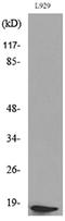 Eukaryotic translation initiation factor 5A-1 antibody, P01727, Boster Biological Technology, Western Blot image 