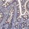 Chromosome 11 Open Reading Frame 96 antibody, NBP1-90866, Novus Biologicals, Immunohistochemistry paraffin image 