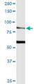 Transient Receptor Potential Cation Channel Subfamily V Member 5 antibody, H00056302-M02, Novus Biologicals, Western Blot image 