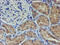 Leukocyte Cell Derived Chemotaxin 2 antibody, M05938, Boster Biological Technology, Immunohistochemistry paraffin image 