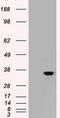 Caudal Type Homeobox 2 antibody, CF500252, Origene, Western Blot image 