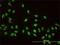 A-Kinase Anchoring Protein 8 antibody, H00010270-M01, Novus Biologicals, Immunocytochemistry image 