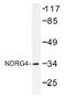 NDRG Family Member 4 antibody, AP01498PU-N, Origene, Western Blot image 