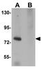 SEC14 And Spectrin Domain Containing 1 antibody, GTX85164, GeneTex, Western Blot image 