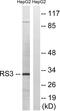 Ribosomal Protein S3 antibody, LS-C119646, Lifespan Biosciences, Western Blot image 