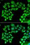 TIMP Metallopeptidase Inhibitor 4 antibody, LS-C334704, Lifespan Biosciences, Immunofluorescence image 