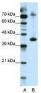 NF-kappa-B-repressing factor antibody, TA345220, Origene, Western Blot image 