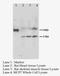 MAS Related GPR Family Member X1 antibody, LS-C171959, Lifespan Biosciences, Western Blot image 