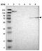 Cyclic nucleotide-gated olfactory channel antibody, NBP1-85527, Novus Biologicals, Western Blot image 