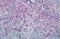 C-C Motif Chemokine Receptor 8 antibody, MBS241419, MyBioSource, Immunohistochemistry frozen image 