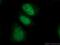 DNA Ligase 3 antibody, 26583-1-AP, Proteintech Group, Immunofluorescence image 