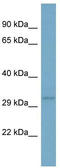 TNF Superfamily Member 13b antibody, TA344292, Origene, Western Blot image 