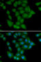 Calcium/Calmodulin Dependent Protein Kinase I antibody, STJ29098, St John