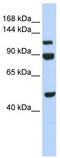 N(Alpha)-Acetyltransferase 16, NatA Auxiliary Subunit antibody, TA346824, Origene, Western Blot image 