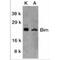 BCL2 Like 11 antibody, TA305980, Origene, Western Blot image 