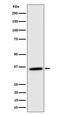 Malate dehydrogenase, mitochondrial antibody, M04803, Boster Biological Technology, Western Blot image 