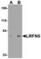 Leucine Rich Repeat And Fibronectin Type III Domain Containing 5 antibody, MBS151138, MyBioSource, Western Blot image 