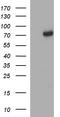 Methyltransferase Like 25 antibody, TA507325, Origene, Western Blot image 