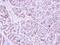 Pituitary Tumor-Transforming 2 antibody, PA5-30881, Invitrogen Antibodies, Immunohistochemistry frozen image 