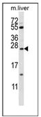Pulmonary surfactant-associated protein C antibody, AP53886PU-N, Origene, Western Blot image 