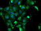 N-Ribosyldihydronicotinamide:Quinone Reductase 2 antibody, M03112-2, Boster Biological Technology, Immunofluorescence image 