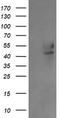 UDP-GlcNAc:betaGal beta-1,3-N-acetylglucosaminyltransferase 2 antibody, TA505331BM, Origene, Western Blot image 