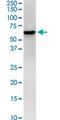 HCLS1 Binding Protein 3 antibody, MA5-22490, Invitrogen Antibodies, Western Blot image 
