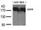 Apoptosis Associated Tyrosine Kinase antibody, orb15026, Biorbyt, Western Blot image 