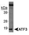Cyclic AMP-dependent transcription factor ATF-3 antibody, TA336705, Origene, Western Blot image 