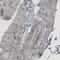 3-ketoacyl-CoA thiolase B, peroxisomal antibody, AMAb91023, Atlas Antibodies, Immunohistochemistry paraffin image 