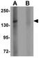 Zinc Finger MYM-Type Containing 1 antibody, GTX32000, GeneTex, Western Blot image 