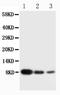 Platelet Factor 4 antibody, PA1446, Boster Biological Technology, Western Blot image 