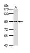 FACT antibody, GTX111816, GeneTex, Western Blot image 