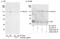 Serine/threonine-protein phosphatase 1 regulatory subunit 10 antibody, A300-440A, Bethyl Labs, Immunoprecipitation image 