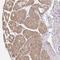 Zw10 Kinetochore Protein antibody, HPA051253, Atlas Antibodies, Immunohistochemistry paraffin image 
