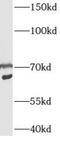 Cysteine And Serine Rich Nuclear Protein 1 antibody, FNab00755, FineTest, Western Blot image 