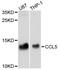 C-C Motif Chemokine Ligand 5 antibody, A5630, ABclonal Technology, Western Blot image 