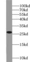 Rho GDP Dissociation Inhibitor Beta antibody, FNab00555, FineTest, Western Blot image 