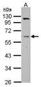 GC Vitamin D Binding Protein antibody, NBP2-20863, Novus Biologicals, Western Blot image 