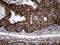 Translocase Of Inner Mitochondrial Membrane 8A antibody, LS-C792209, Lifespan Biosciences, Immunohistochemistry paraffin image 