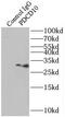Programmed Cell Death 10 antibody, FNab06237, FineTest, Immunoprecipitation image 