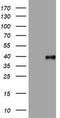 Phosphatidylinositol-4-phosphate 3-kinase C2 domain-containing subunit alpha antibody, TA801708AM, Origene, Western Blot image 