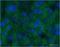 Cellular Communication Network Factor 2 antibody, ab6992, Abcam, Immunohistochemistry frozen image 