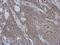 Coiled-Coil Domain Containing 90B antibody, NBP2-15756, Novus Biologicals, Immunohistochemistry paraffin image 