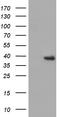 3-Hydroxyisobutyryl-CoA Hydrolase antibody, CF501316, Origene, Western Blot image 