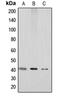 Atypical Chemokine Receptor 3 antibody, LS-C353514, Lifespan Biosciences, Western Blot image 