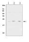 TIMP Metallopeptidase Inhibitor 1 antibody, PA1385, Boster Biological Technology, Western Blot image 