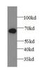 Alpha-1-B Glycoprotein antibody, FNab00012, FineTest, Western Blot image 