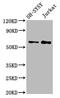 Alpha-1,3-Mannosyl-Glycoprotein 4-Beta-N-Acetylglucosaminyltransferase B antibody, CSB-PA890781LA01HU, Cusabio, Western Blot image 